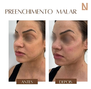 lanouclinica.analiafranco__2024-11-04T185751.000Z copiar