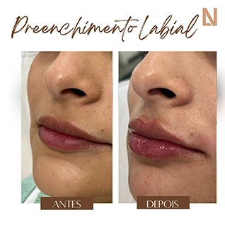 lanouclinica.analiafranco__2024-11-11T231758.000Z copiar